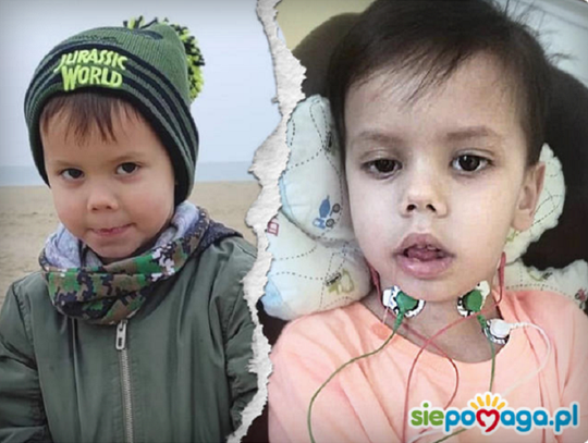  Mikołajek, Wiesław oraz Marcelina z Elbląga i okolic potrzebują pomocy