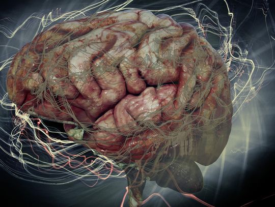Neurolog - co leczy? Przegląd chorób neurologicznych