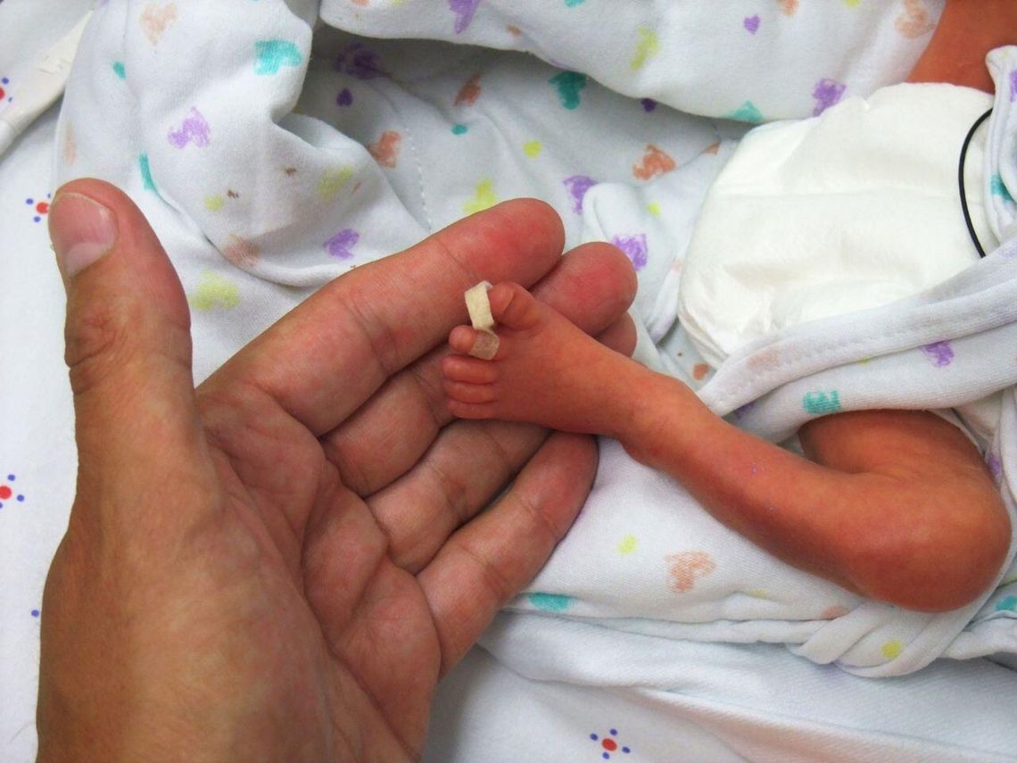 Spotkanie Małych Bohaterów – Światowy Dzień Wcześniaka Spotkanie Małych Bohaterów – Światowy Dzień Wcześniaka