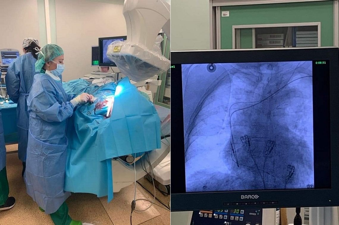 "To pierwsze takie zabiegi w elbląskim szpitalu" "To pierwsze takie zabiegi w elbląskim szpitalu"